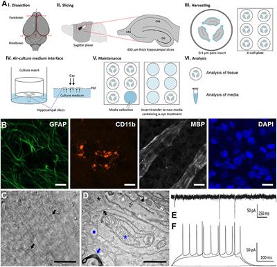 Exposure of α-Synuclein Aggregates to Organotypic Slice Cultures Recapitulates Key Molecular Features of Parkinson's Disease